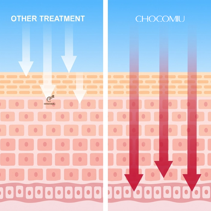 Chocomiu Skin Balance